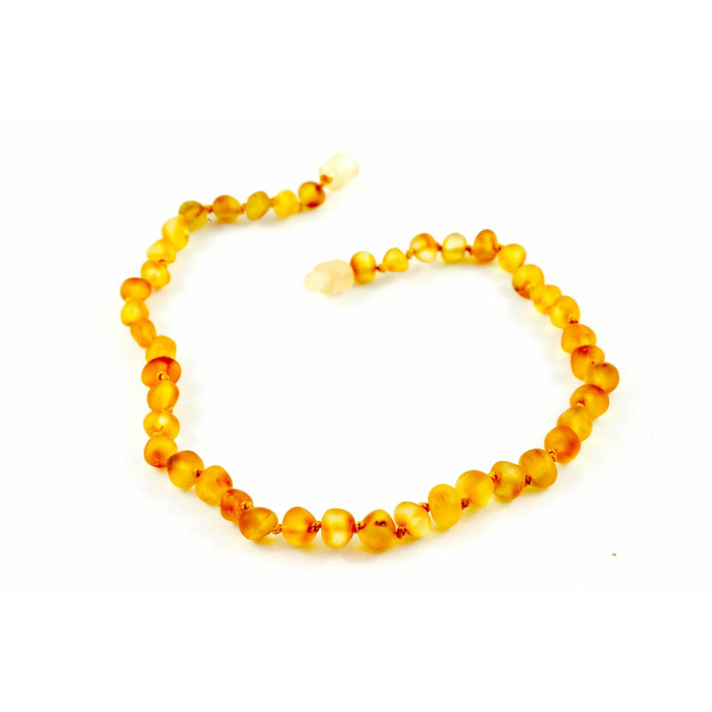 Healing hazel on sale amber necklace